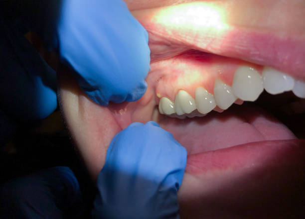 Best Pediatric Emergency Dentist in Shullsburg, WI